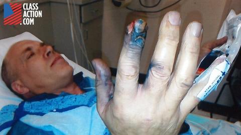 Florida Man Files Lawsuit After Vape Explosion