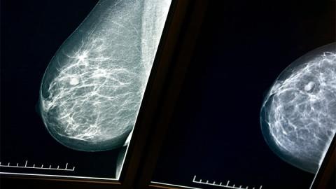 There Are Now Roughly 20,000 Risperdal Lawsuits
